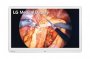 LG 32HR743S-W | 32-inch Medical Mini LED IPS 4k Surgical Monitor